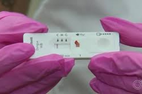Com mais de 5 mil casos prováveis de dengue, Acre tem maior incidência do país a cada 100 mil habitantes